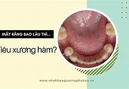 Học Răng Hàm Mặt Bao Lâu